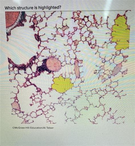 Solved Which Structure Is Highlighted Alveolar Duct Small Chegg