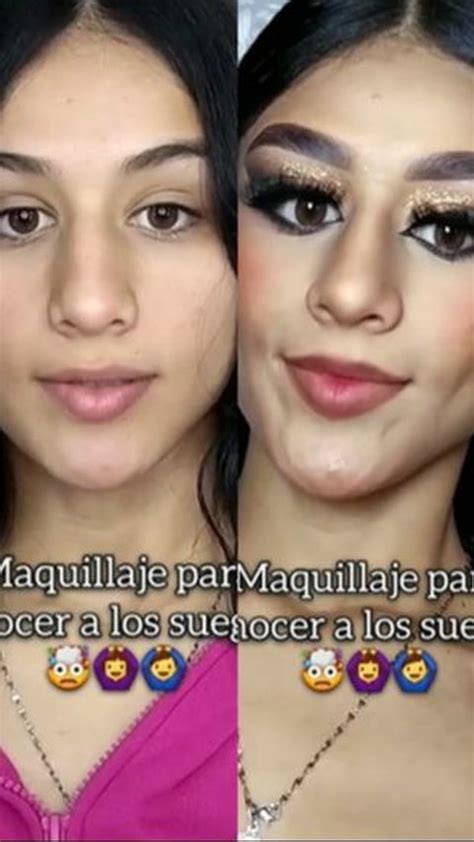 Plastic Surgeon Tiktok Goes Viral For Before After Video Of Patient