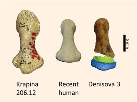 Denisovan Fingers Are Indistinguishable From Those Of Modern Humans