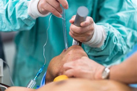 Intubación endotraqueal qué es para qué sirve y cómo es realizada