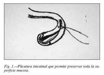 Estrategias quirúrgicas en el intestino corto