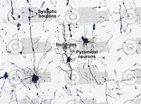 Mammal Cerebral Cortex Neuron Silver Stain X Neuron Mammals