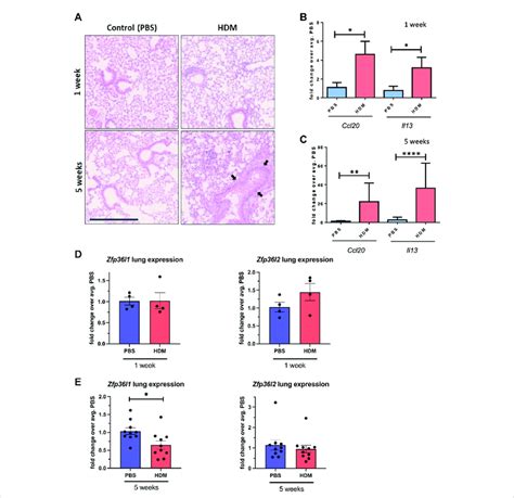 Zfp36l1 And Zfp36l2 MRNA Expression In The Lungs Different Mouse Models