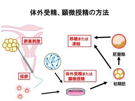 不妊治療｜梅ヶ丘産婦人科