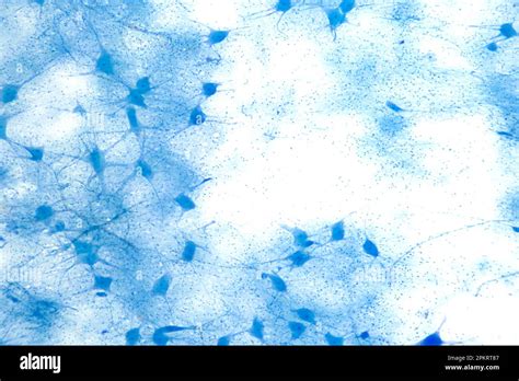 Motor Neuron Cells Whole Mount 8X Light Micrograph Motoneurons Under