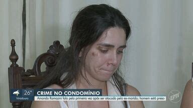 Mulher Fala Pela Primeira Vez Depois De Ser Atacada Pelo Ex Marido