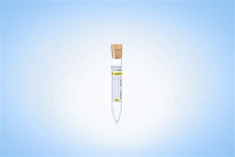 Medical Disposable Sterile Vacuum Boric Acid Urine Sample Collection