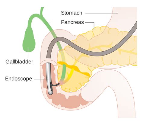 Endoscopy - Private Surgeon Milton Keynes