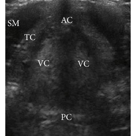 Normal Lung Ultrasound A D Red Arrows Point To The Pleura Where