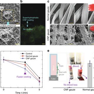 Facile Clot Detachment A Illustration Of Fibrin Fibers Formation From