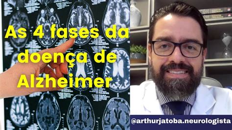 Fases Da Doen A De Alzheimer Entenda A Progress O Dos Sintomas