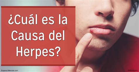 Cu Les Son Las Causas Del Herpes