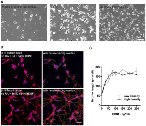 Automatic Quantification Of Neurite Outgrowth In Ra Bdnf Differentiated