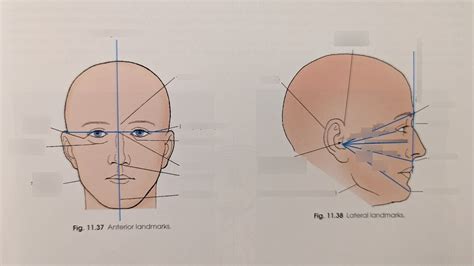 Skull Topography Diagram Quizlet