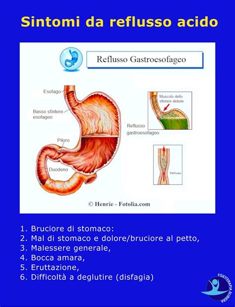 Come Curare L Ernia Iatale Con Osteopatia E Rimedi Naturali