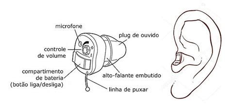 Como Funcionam Os Aparelhos Auditivos