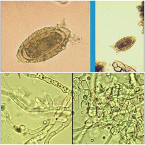 Urinalysis Lecture 4 Diagram Quizlet