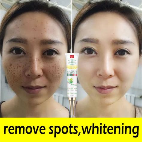 Serum For Face To Remove Dark Spot Serum For Face Whitening Dark Spot