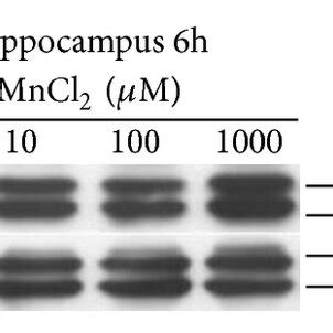 Effect Of Mncl On Mapks Phosphorylation Erk Jnk And