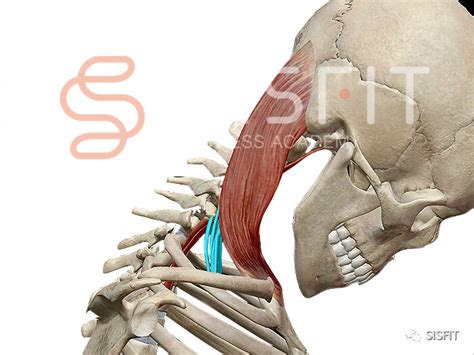 斜角肌触发点与松解 哔哩哔哩