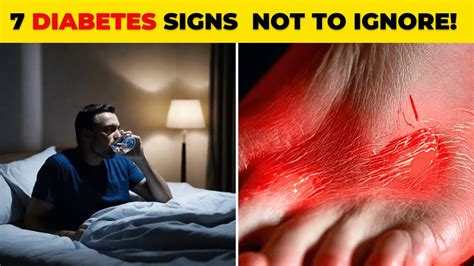 7 Nighttime Signs Of Diabetes You Shouldn T Ignore Youtube