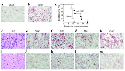 Blockade Of Vegf In A Fully Mhc Mismatched Murine Model Of Acute