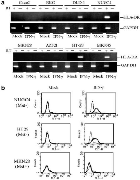 Expression Of Hla Dr In Colorectal And Gastric Cancer Cell Lines A