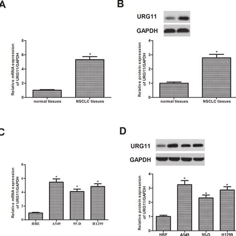 Urg Is Highly Expressed In Nsclc Tissues And Cell Lines A The