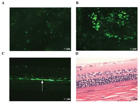 Ultrasound Targeted Microbubble Destruction Enhances Polyethylenimine