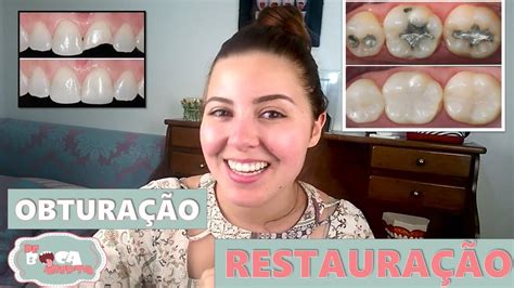 Obturação Do Dente Restauração Dentária Youtube