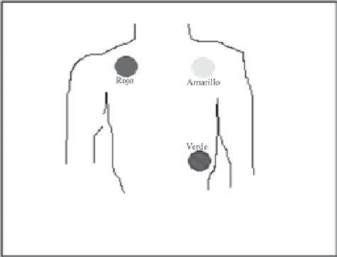 1 Colocación Correcta De Los Electrodos Download Scientific Diagram