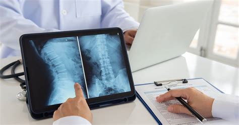 Common Complications After A Spinal Cord Injury