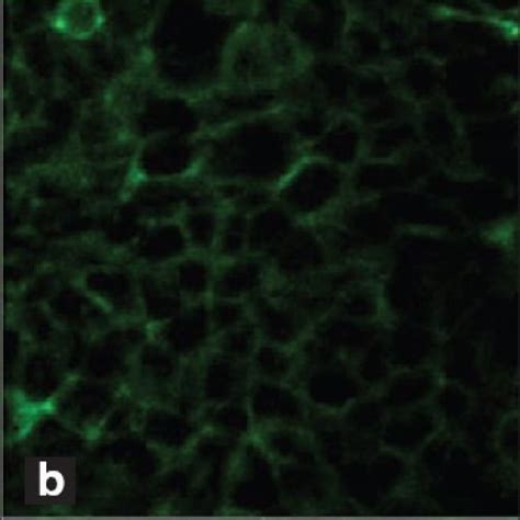 Confocal Images 20 Of Caco 2 Cell Tight Junction Protein ZO 1 A