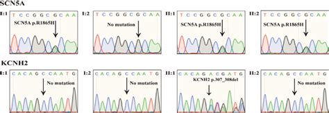 Sanger Sequencing For Scn A And Kcnh Mutations Kcnh P Del And