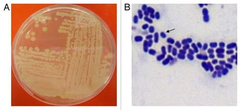 Acinetobacter Baumannii Gram Stain