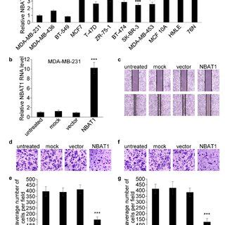 Over Expression Nbat Inhibits The Migration And Invasion Of