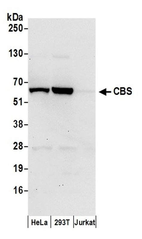 Cbs Polyclonal Antibody A304 780a T