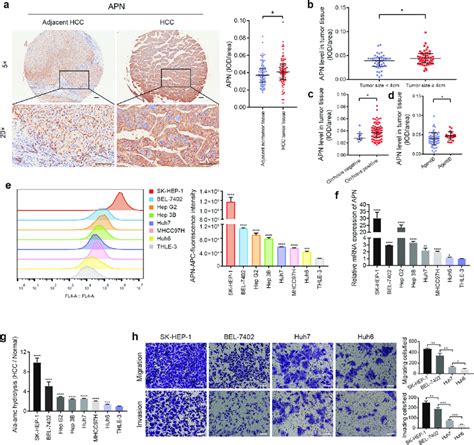 Apn Expression Is Upregulated In Hcc Tissues And High Metastatic Hcc