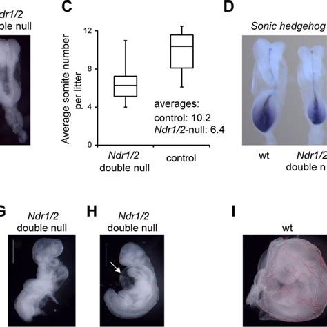 Ndr Double Null Mice Are Embryonic Lethal But A Single Ndr Allele