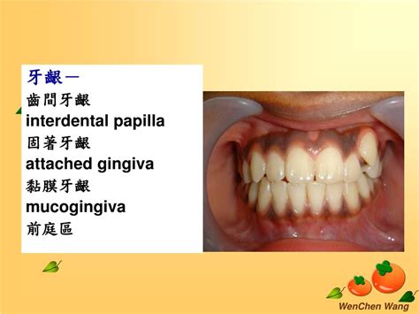 Ppt Oral Mucosa Powerpoint Presentation Free Download Id5775685