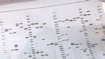 Gentechnik II Identifizierungsmethoden Southern Blot 1