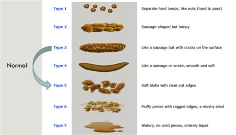 Disorders Of The Small Intestine And Colon Flashcards Quizlet