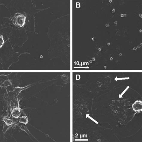 Scanning Electron Micrographs Of Platelets From Healthy Volunteers