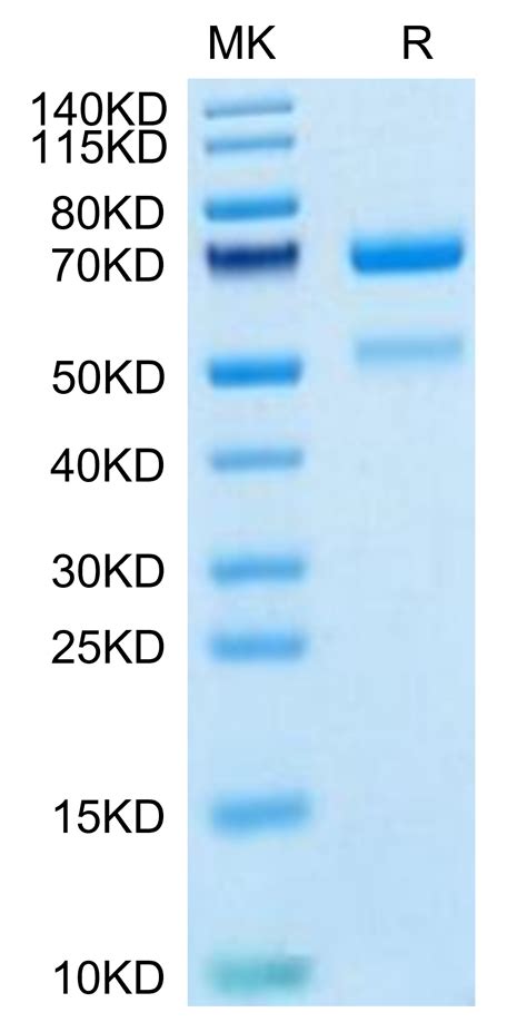 Human Ctgf Ccn Protein Cgf Hm Kactus