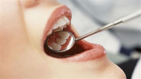 Common Dental Problem And How To Prevent Them