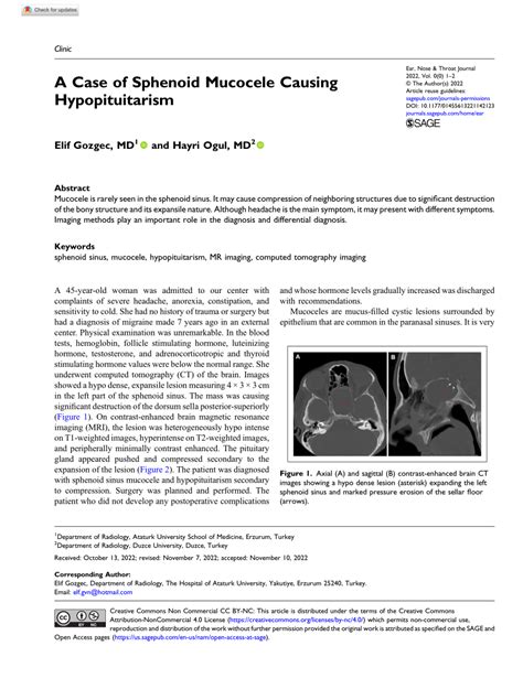 Pdf A Case Of Sphenoid Mucocele Causing Hypopituitarism