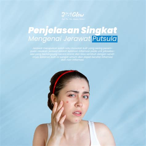 Penjelasan Singkat Mengenai Jerawat Putsula Jglow Clinic