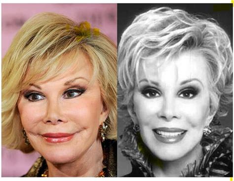 15 Celebrity Nose Jobs Yay Or Nay Social Azarask
