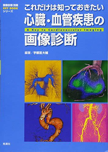 これだけは知っておきたい心臓・血管疾患の画像診断 画像診断別冊keybookシリーズ 宇都宮大輔 宇都宮大輔 本 通販