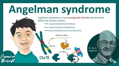 Angelman Syndrome Molecular Basis Of Angelman Syndrome Pathology And Genetics Of Angelman